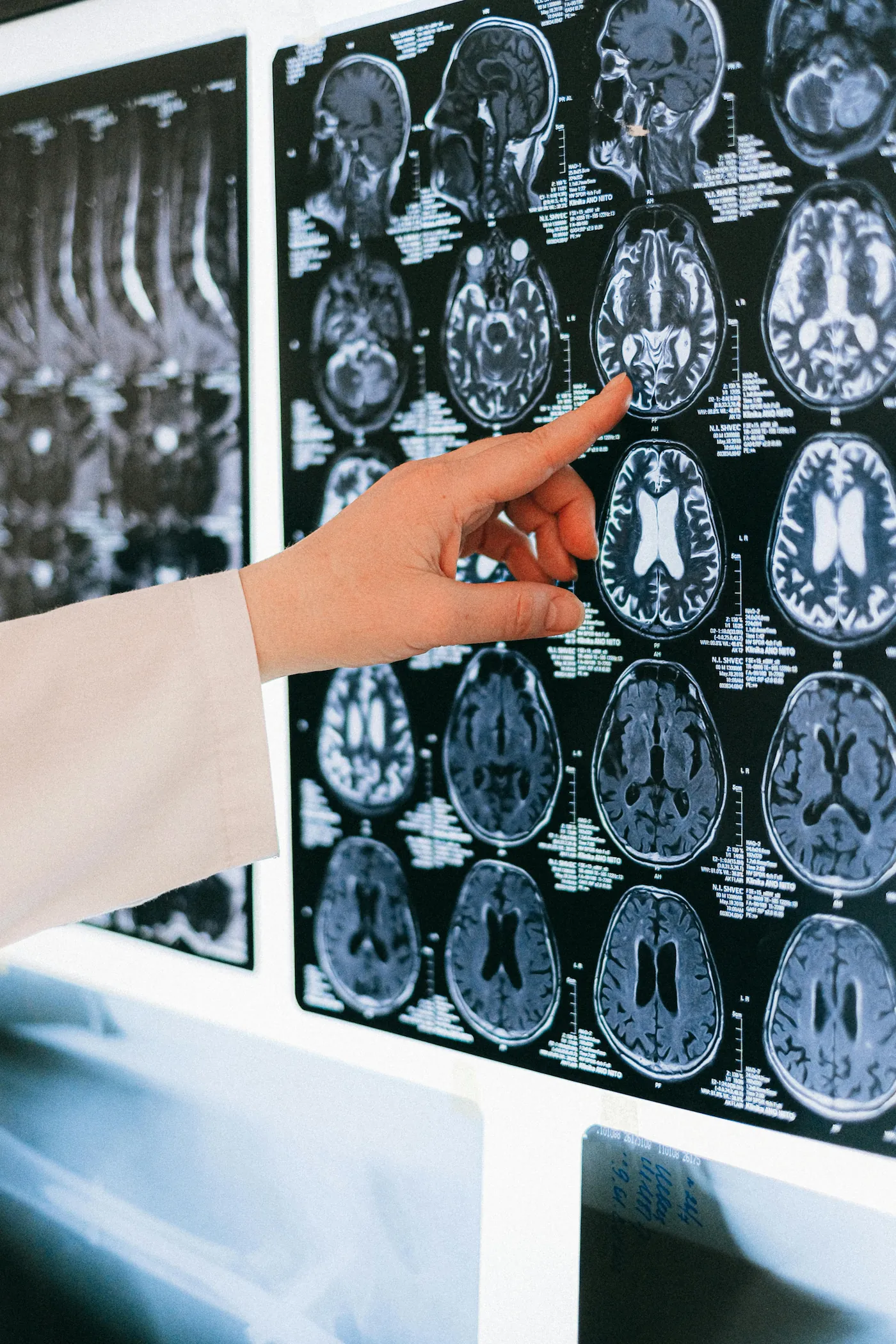Neurología